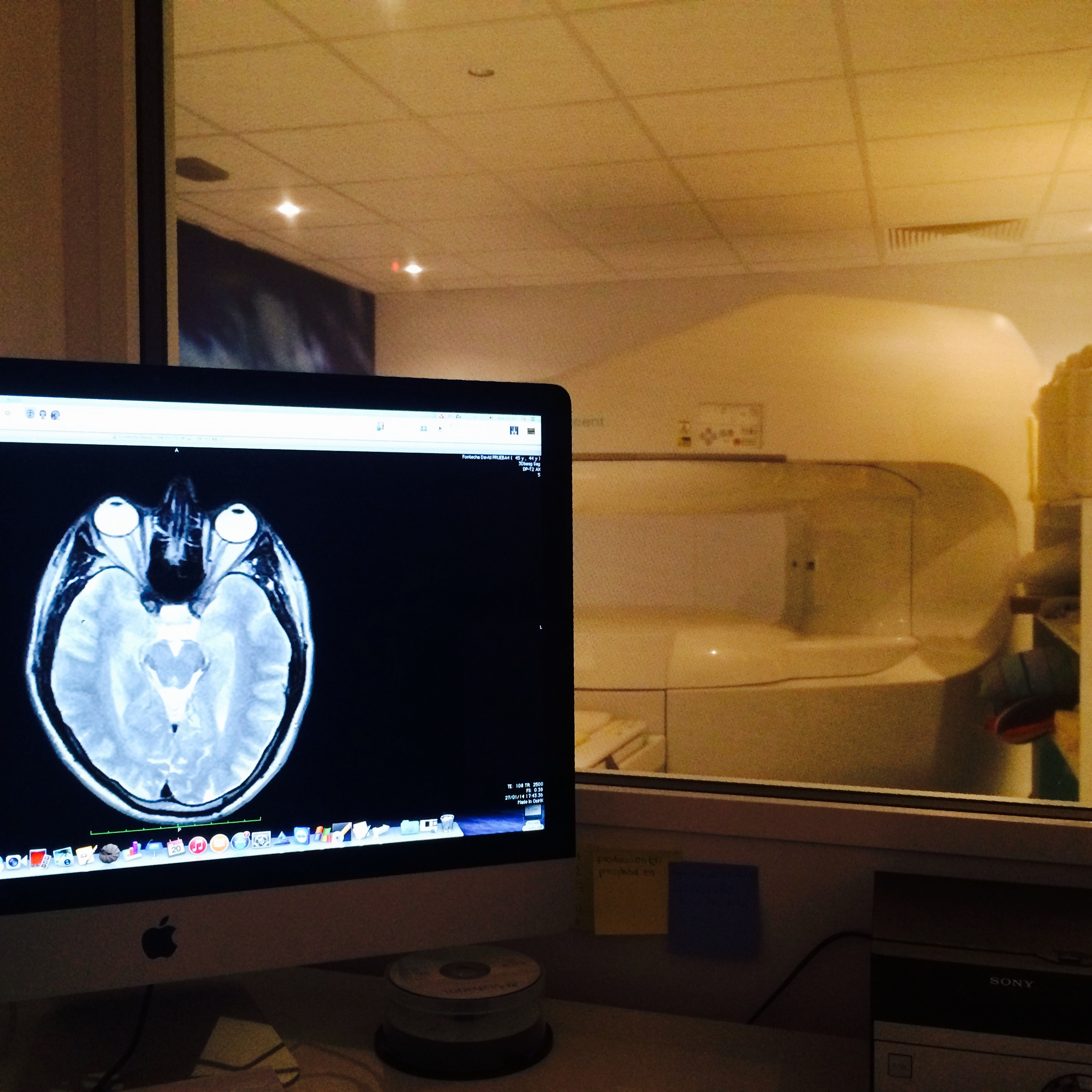 resonancia magn&eacute;tica